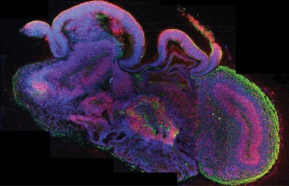 lab-grown brain tissue