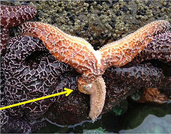starfish disease