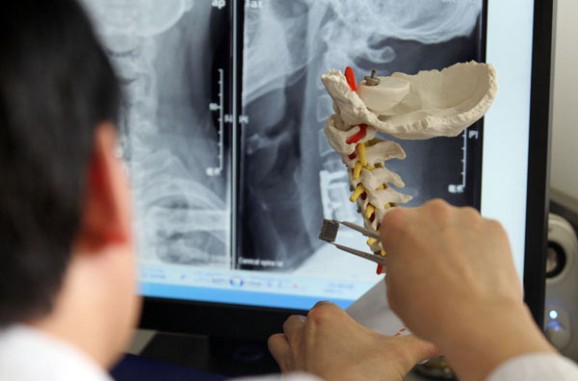 3d printed spinal implant