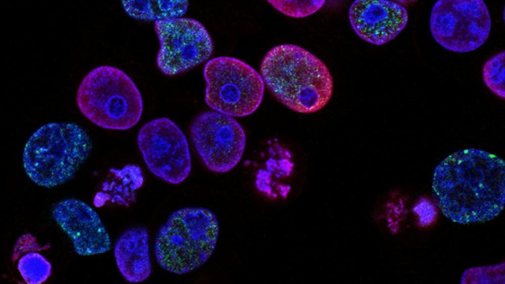 تدمر الجزيئات المهتزة 99% من الخلايا السرطانية، ويطلق عليها العلماء اسم الجيل الجديد تمامًا